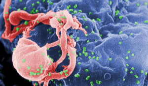 This undated photo provided by the Centers for Disease Control and Prevention shows a scanning electron micrograph of multiple round bumps of the HIV-1 virus on a cell surface. (Cynthia Goldsmith/Centers for Disease Control and Prevention via AP)