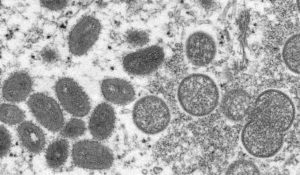 This electron microscopic image depicts a monkeypox virion, obtained from a clinical sample associated with the 2003 prairie dog outbreak. (Cynthia S. Goldsmith, Russell Regnery via AP)