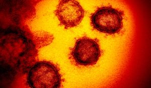 An undated electron microscope image from the U.S. National Institutes of Health in February 2020 shows the virus that causes COVID-19. (NIAID-RML via AP, File)