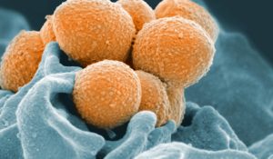 This handout image provided by the National Institute of Allergy and Infectious Diseases shows an electron microscope image of Group A Streptococcus (orange) during phagocytic interaction with a human neutrophil (blue). (National Institute of Allergy and Infectious Diseases via AP)
